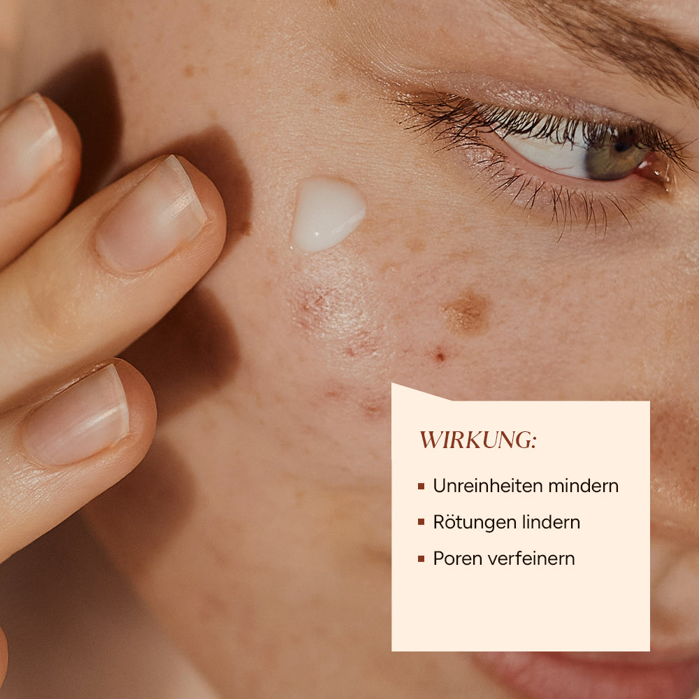 Azelain Serum