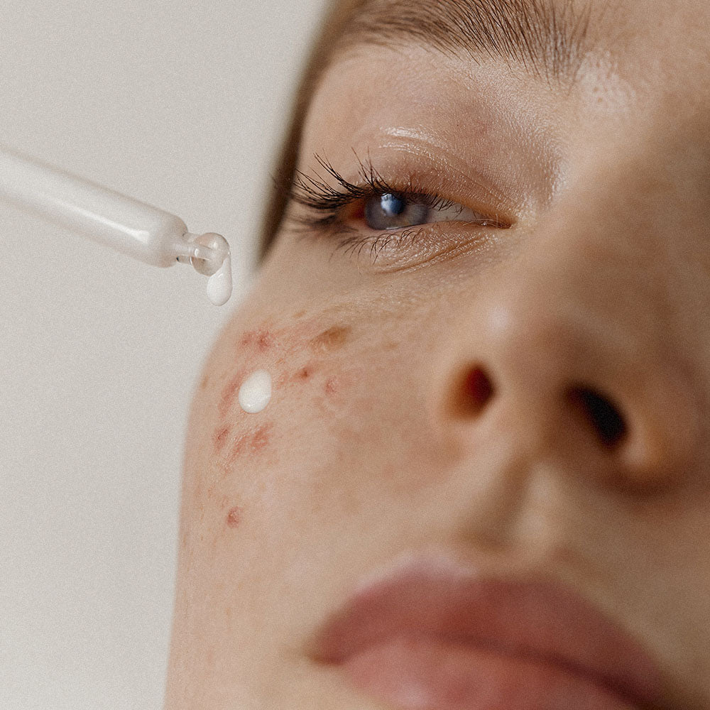 Azelain Serum