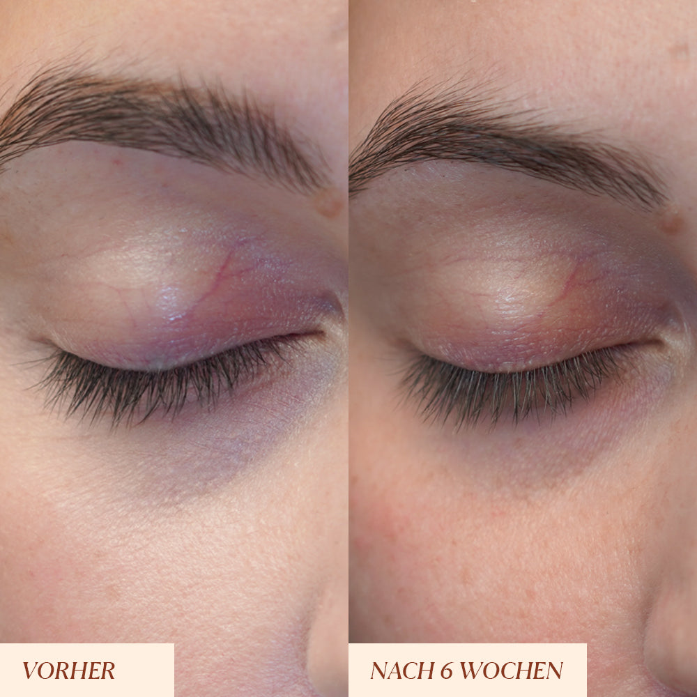 Peptide Wimpernserum
