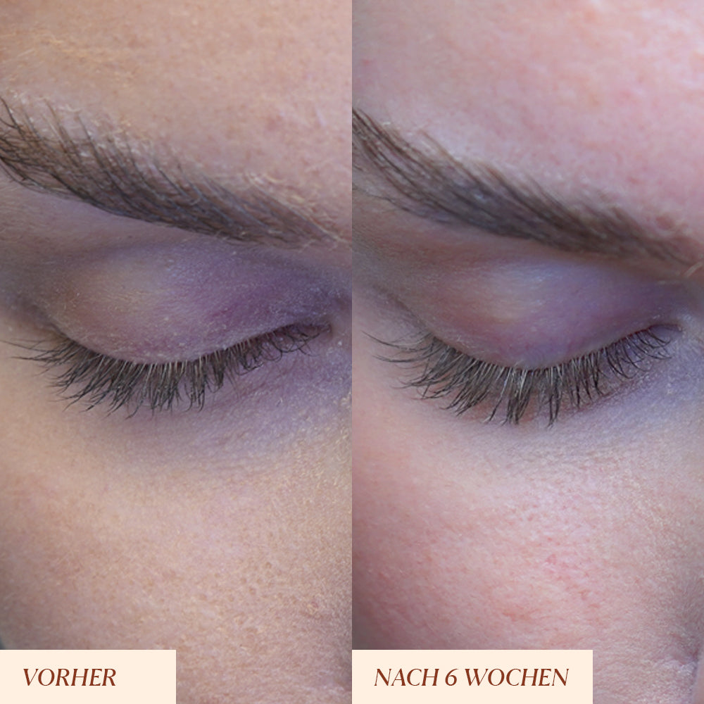 Peptide Wimpernserum